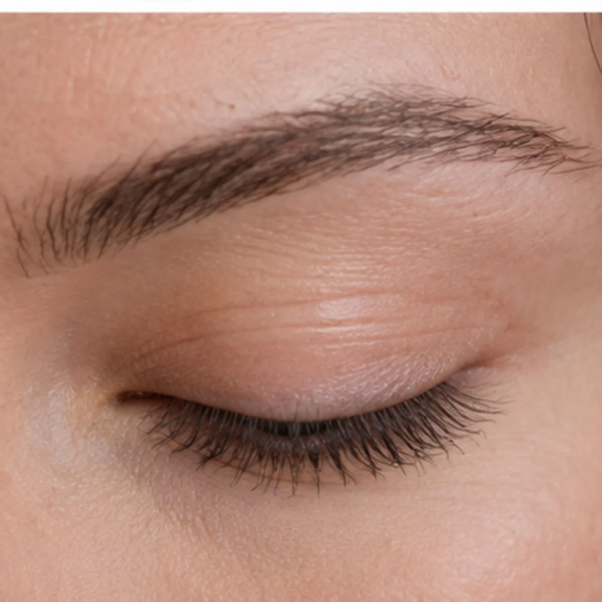 Recuperación y cuidados de la eliminación de ojeras