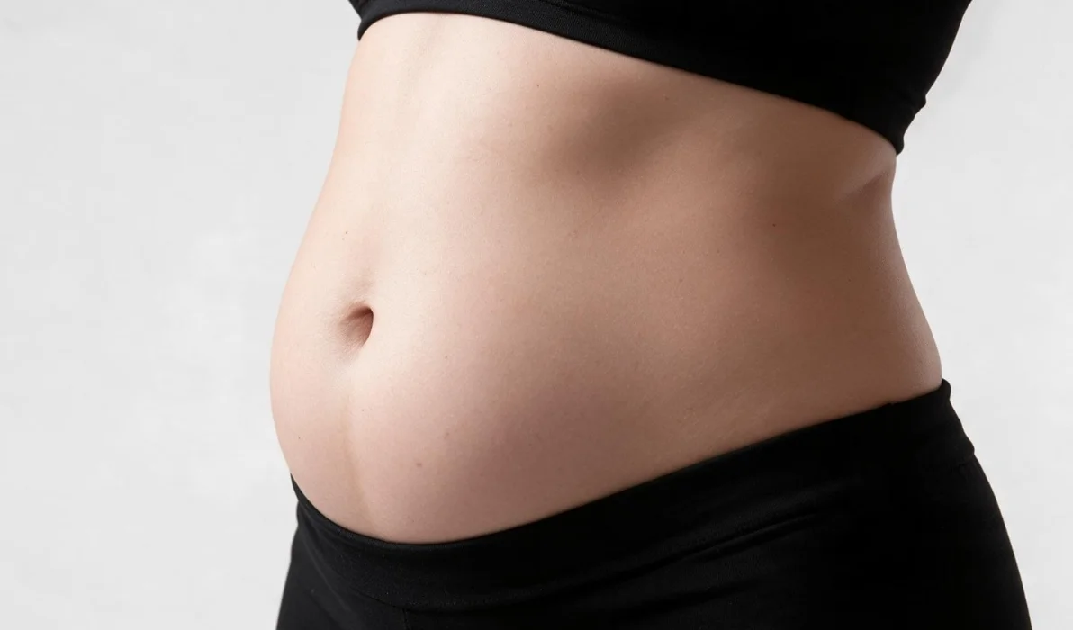 COOLSCULPTING - paciente 3