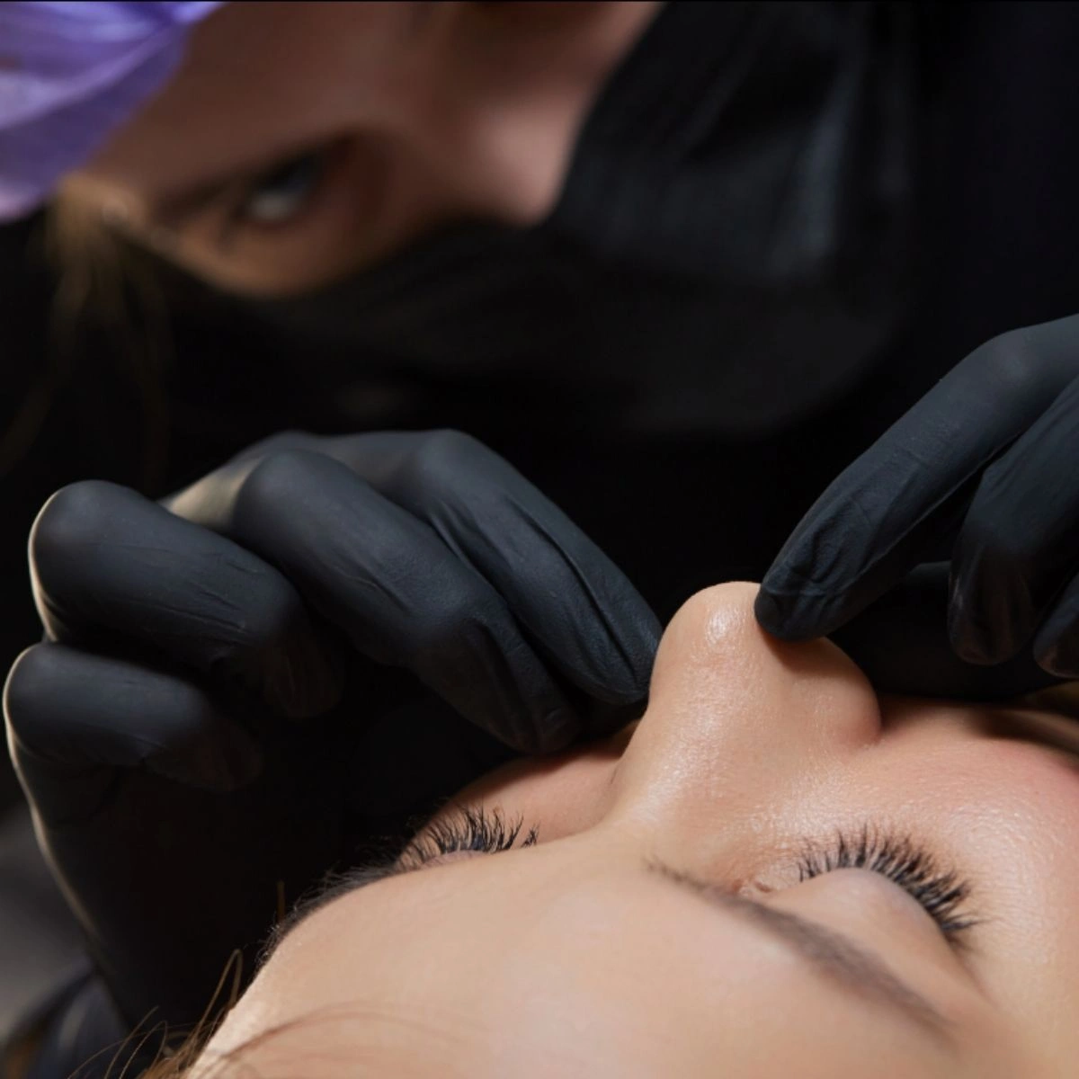 Cirugía facial en Clínicas Dorsia